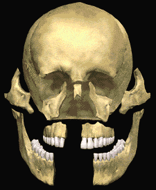 facial trauma