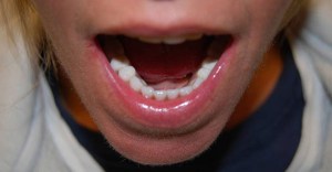 Dental Implants With Nizar Merheb MD