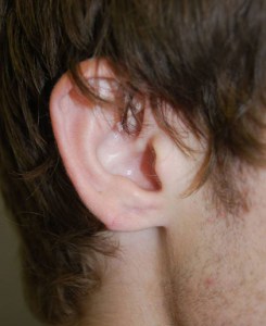 Ears With Nizar Merheb MD