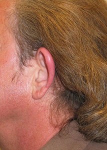 Ears With Nizar Merheb MD