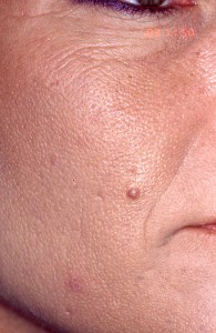 Total Facial Rejuvenation with Nizar Merheb MD