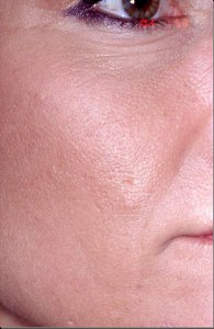 Total Facial Rejuvenation with Nizar Merheb MD