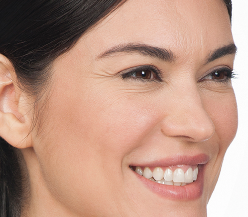 Before photo of BOTOX® Cosmetic - face