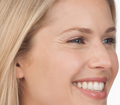Before photo of BOTOX® Cosmetic - face