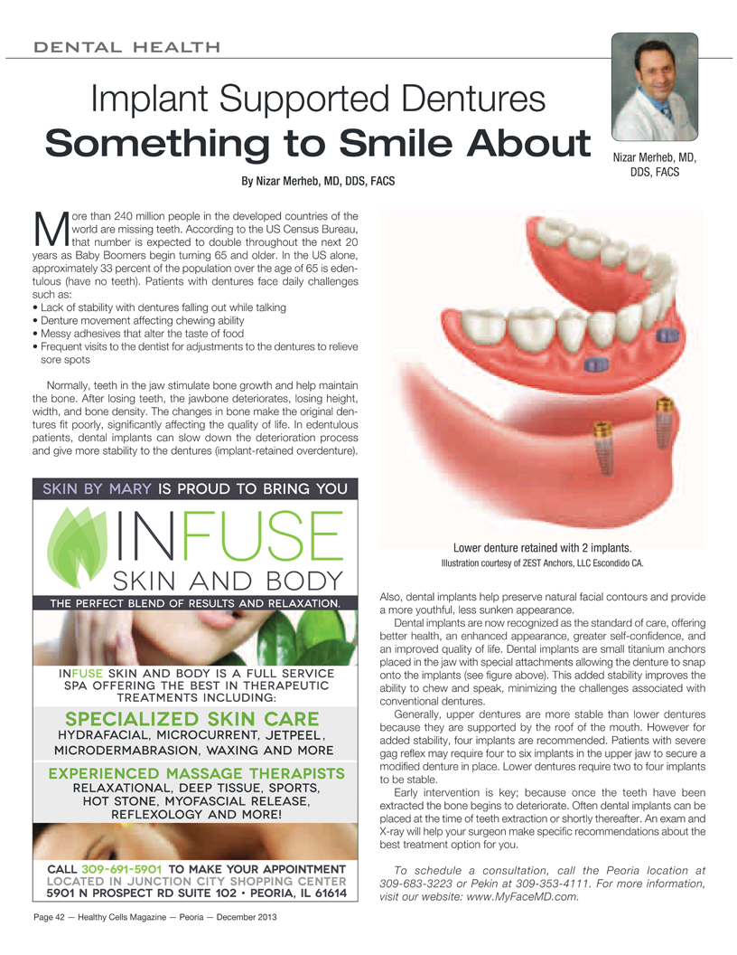 Healthy Cells Article December 2013 Implant Supported Dentures