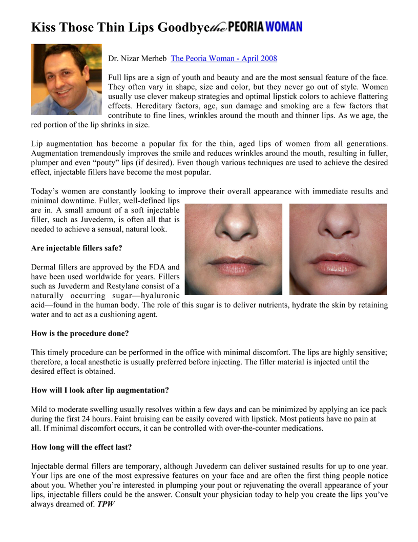 The Peoria Woman Magazine - April 2008 - Kiss Those Thin Lips Goodbye